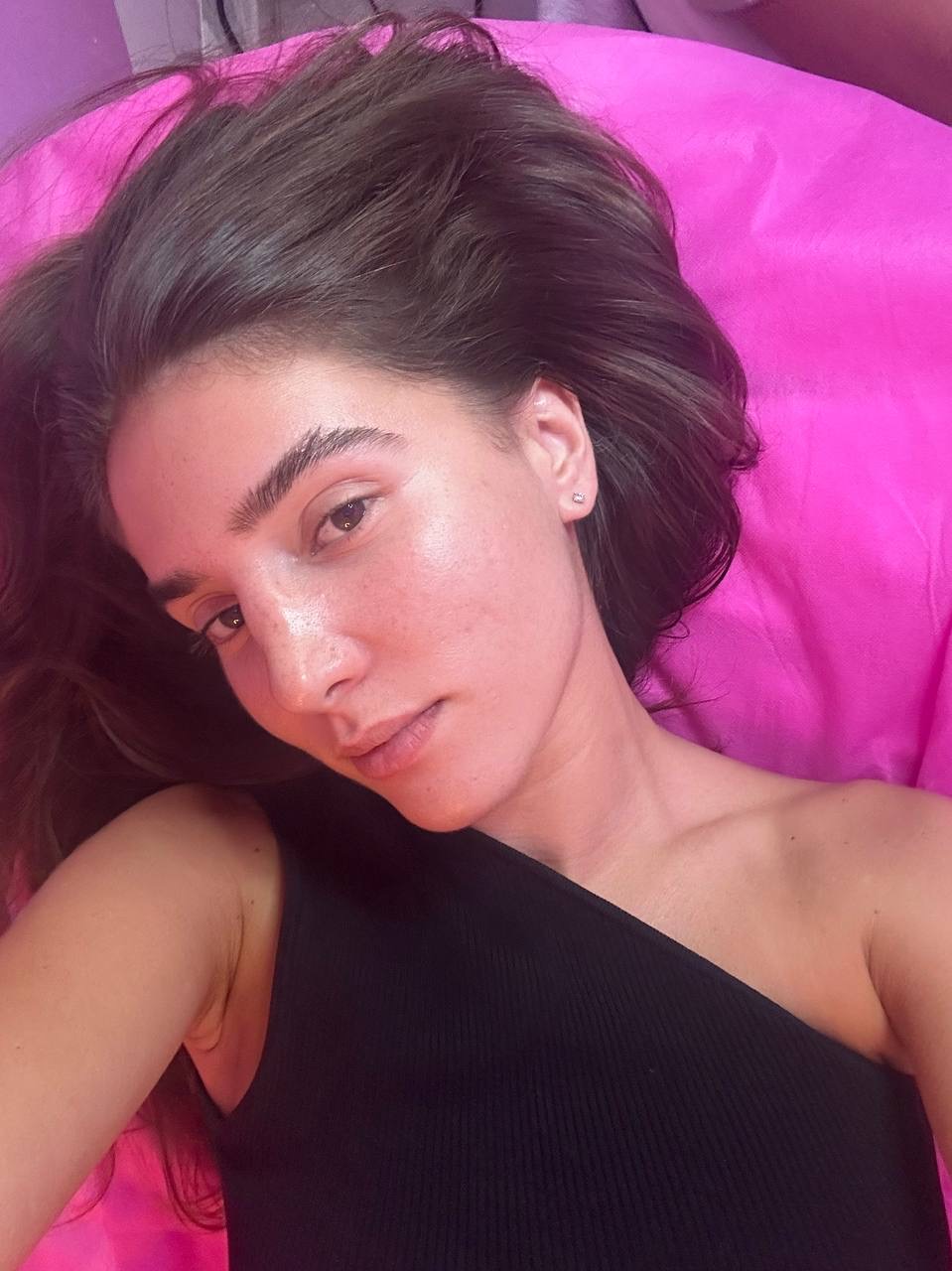 מטופלת עם עור זוהר